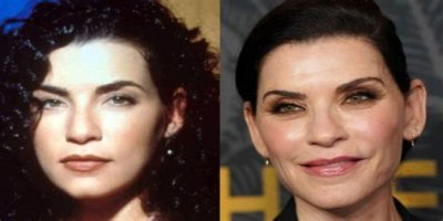 Julianna Margulies Doesnât Look Natural After Plastic Surgery!