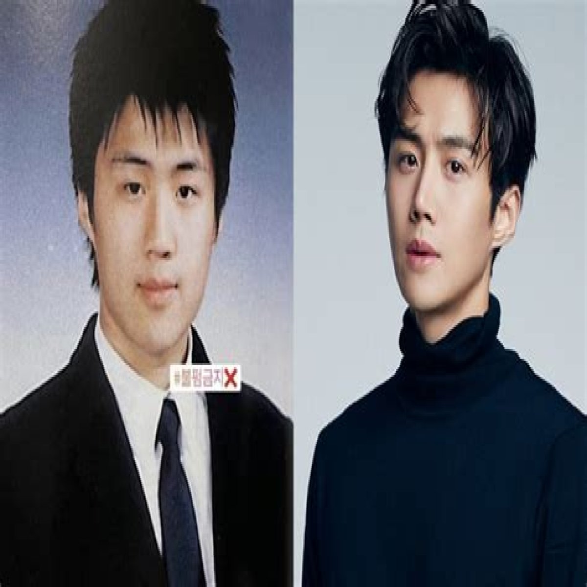 Kim Seon Ho Nose Surgery: Before & After Looks