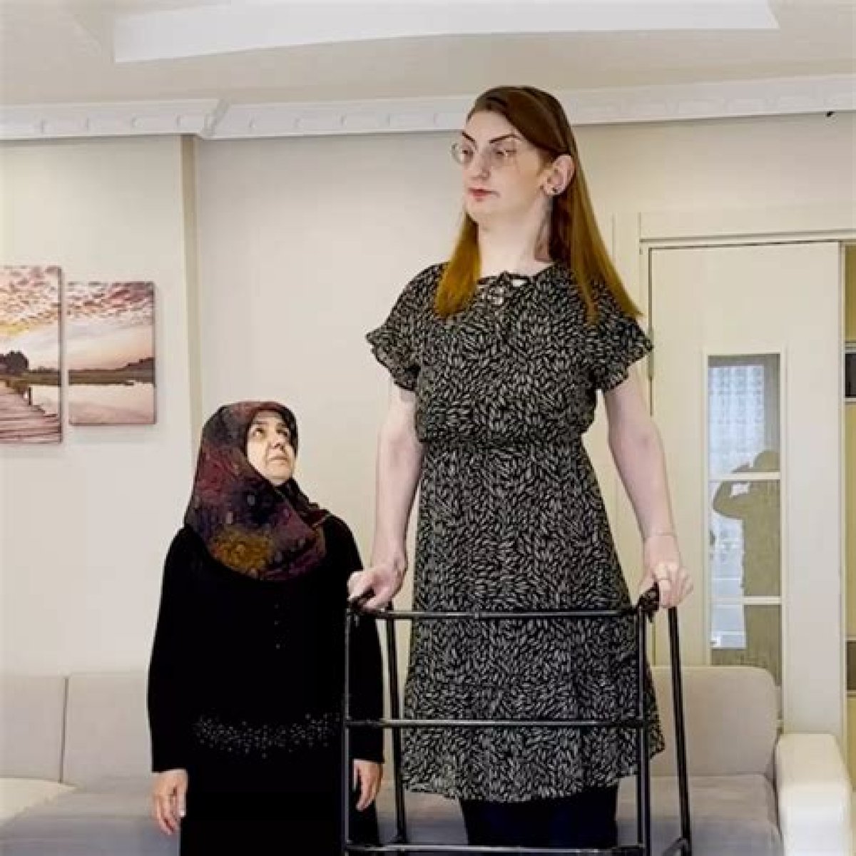 Tallest Woman in The World: Meet Rumeysa Gelgi, The World’s Tallest Woman, Who’s 7Feet Tall
