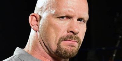Unveiling The Truth: Steve Austin's Baldness Decoded