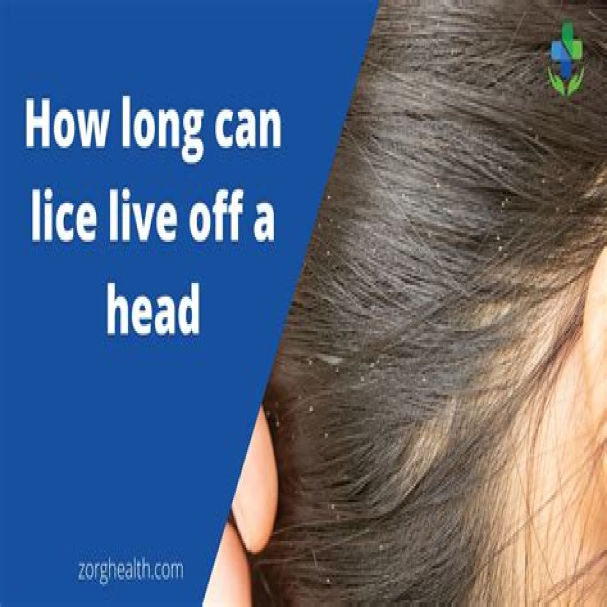 Will bleaching hair kill head lice?
